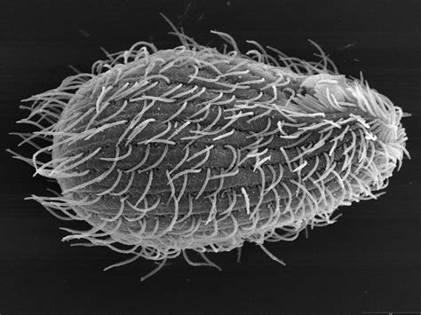  Tetrahymena: A Microscopic Maestro Orchestrating Cellular Ballet!