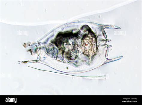  Brachionus! A Microscopic Marvel Mastering Movement in Freshwater