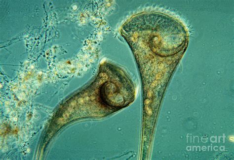  Did You Know That This Tiny Freshwater Ciliate Lives In A World Made Entirely Of Water? Introducing The Jumping Jack