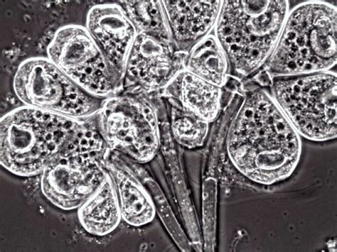  Ephelota: Can These Free-Swimming Ciliates Reveal Ancient Evolutionary Secrets?