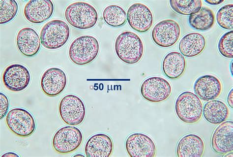  Isospora! Tiny Parasites With Enormous Impact on Animal Health