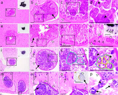 Leucocytozoon! A Tiny Terror Lurking Within Bird Bloodstreams