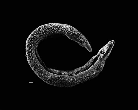  Schistosoma! A Parasite That Thrives on Two Sides of a Bloody Coin