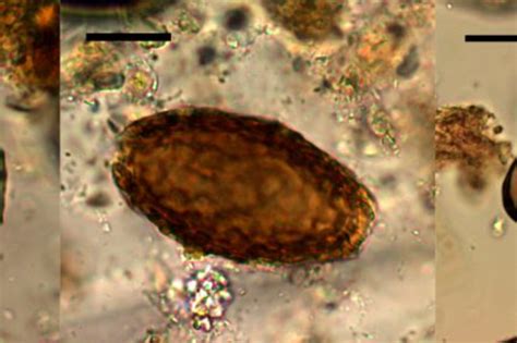  Xenosporidium: Discover This Unusual Parasite That Invades Cells Like a Tiny Spaceship!