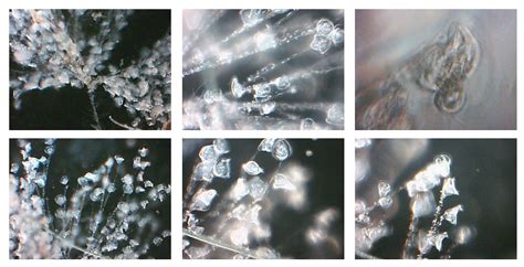  Zoothamnium It thrives as a microscopic colony-forming predator with an incredibly fascinating life cycle!